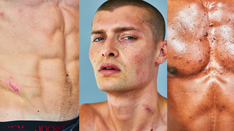 This photographer is showcasing male models and their ‘imperfections’ in a powerful way