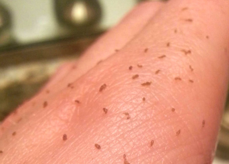 I tried “skin gritting,” the gross new way to remove blackheads