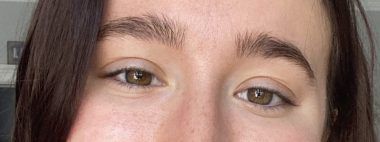 A close up to show the puffiness of my eyes